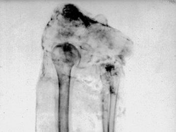 X-ray image of a mummy; it shows an assemblage of bones bundled in cloth.