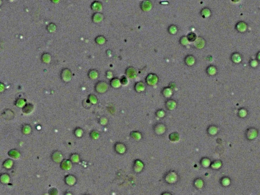 micrograph of isolated chloroplasts that look like green blobs widely spreadout on  on gray background