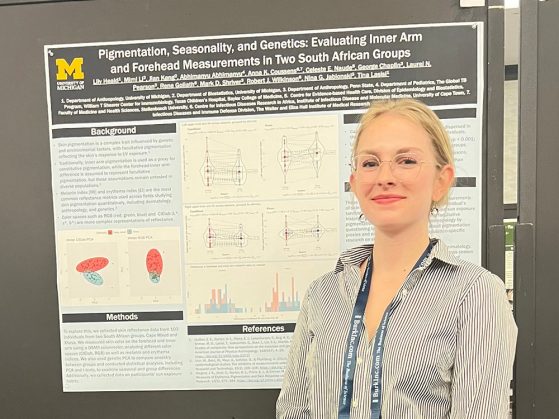 Person in striped shirt with lanyard standing in front of a UM research poster about pigmentation, seasonality, and genetics.