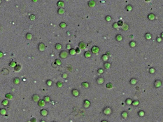 Wierzbicki Lab: Understanding DNA organization in chloroplasts